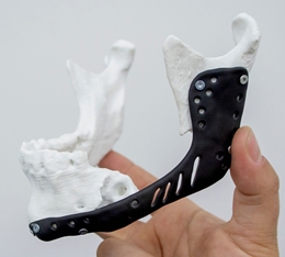 Additive Manufacturing in Implantology: A General Workflow Additive Manufacturing in Implantology: A General Workflow