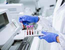 Maintenance Guidelines for Hematology Analyzers Maintenance Guidelines for Hematology Analyzers