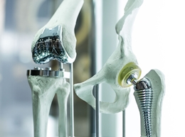 Dangers of Organic and Inorganic Contamination on Forged, Machined, Molded & Electronic Implants Dangers of Organic and Inorganic Contamination on Forged, Machined, Molded & Electronic Implants